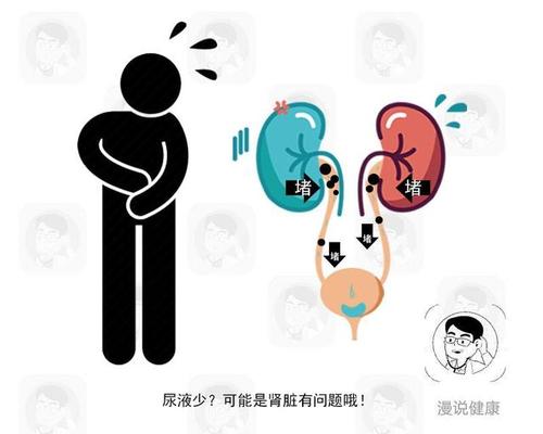 尿毒症常常有4个标志,若超过两个以上,心力衰竭的可能性会增加!
