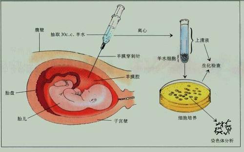 胎儿颈项透明带和唐氏筛查这两项检查出现异常,需要进一步做羊水穿刺
