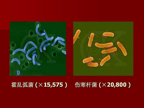 霍乱弧菌 (×15,575   伤寒杆菌 (×20,800