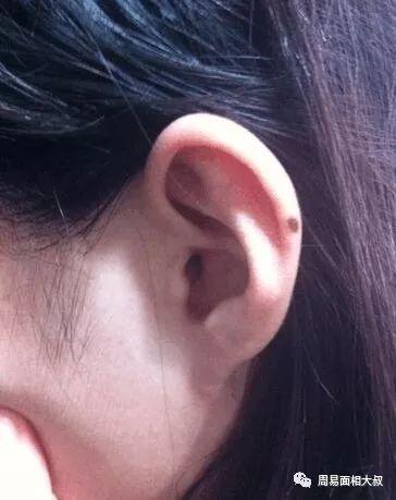 耳朵下面有痣代表什么意思详解!