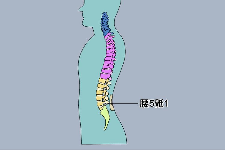腰5/骶1椎间盘突出位置图