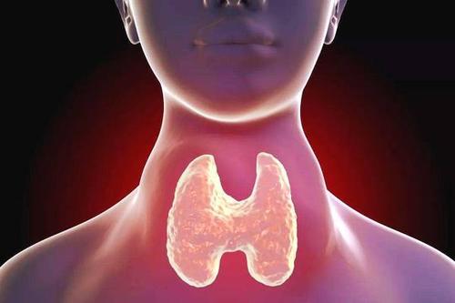 甲状腺结节是指在甲状腺内的肿块,可随吞咽动作随甲状腺而上下叶