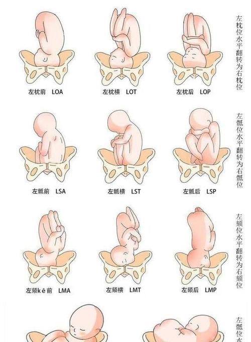 头位:就是枕先露,也就是胎儿的头朝下屁股朝上,这种胎位最适合顺产