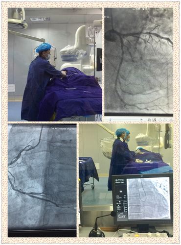 导管进入患者心脏血管,注射造影剂后,血管的形态,狭窄程度在dsa下显影