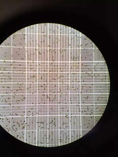 血球计数板视镜下藻细胞数量