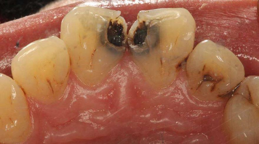 牙体牙髓病科