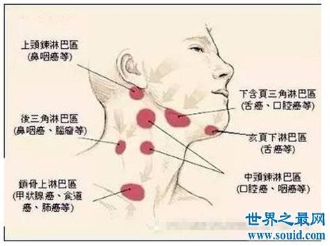 收纳颏部,口底及舌尖等处的淋巴,注入下颌下淋巴结及颈内静脉二腹肌