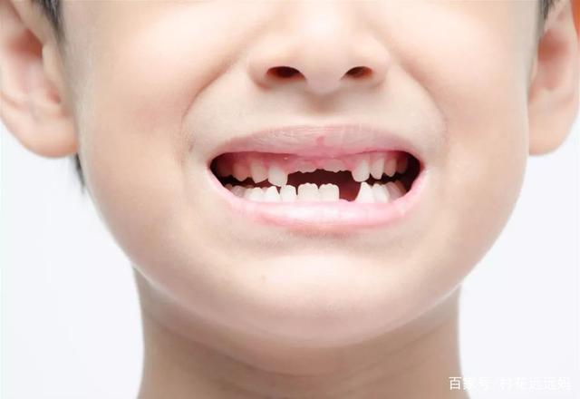 孩子换牙的时间段,什么原因导致换牙时间晚,怎样保护他们牙齿