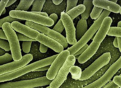 acs nano:致命超级细菌是如何被消灭的?