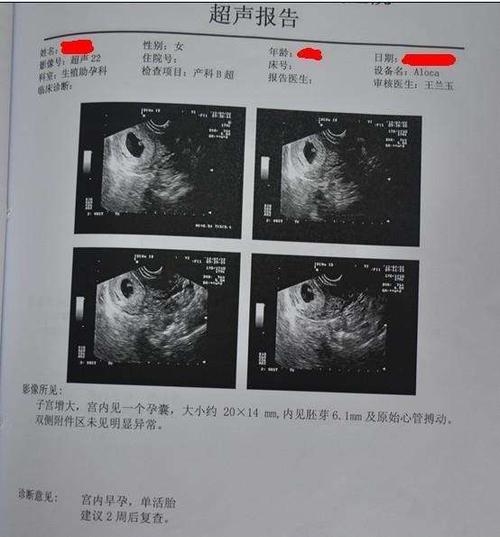 第一次做b超的时候,应当是孕2月后,医生记载数据胎体数据长和宽之比