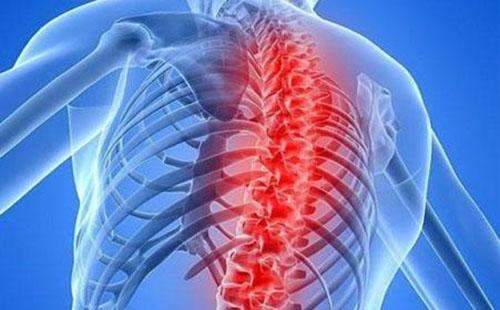 强直性脊柱炎怎么治疗强直性脊柱炎的治疗方法