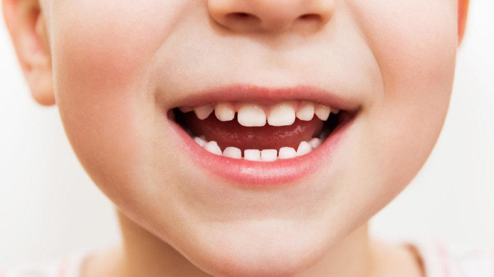 你真以为新西兰儿童看牙全免费?