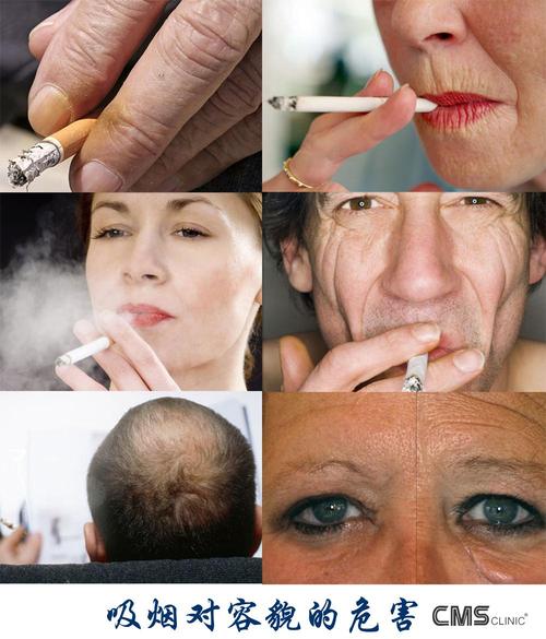 如何缓解吸烟对皮肤的危害