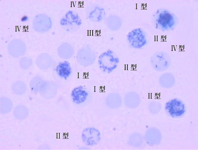 各型网织红细胞_实验诊断学