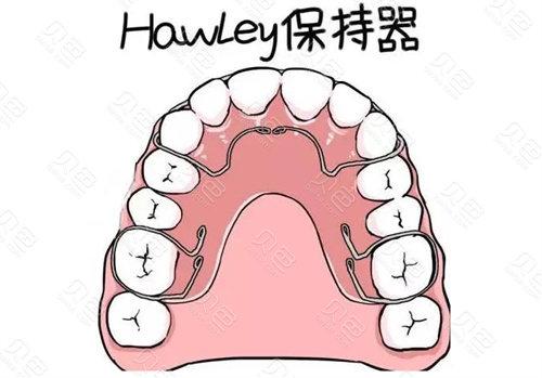 笔者有话说:牙齿保持器是口腔正畸必不可少的一个环节,对牙齿在摘牙套
