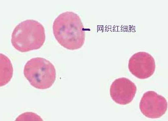 网织红细胞染色方法