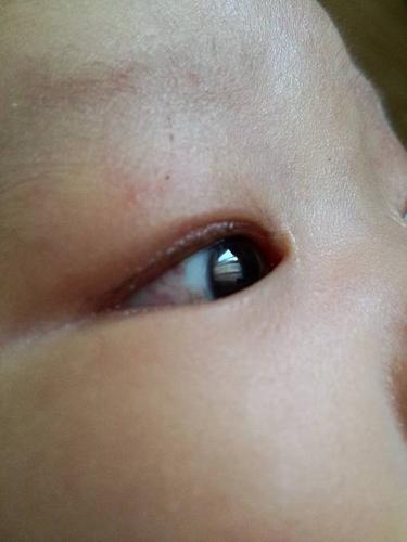 宝宝眼睛里面有红血丝怎么回事