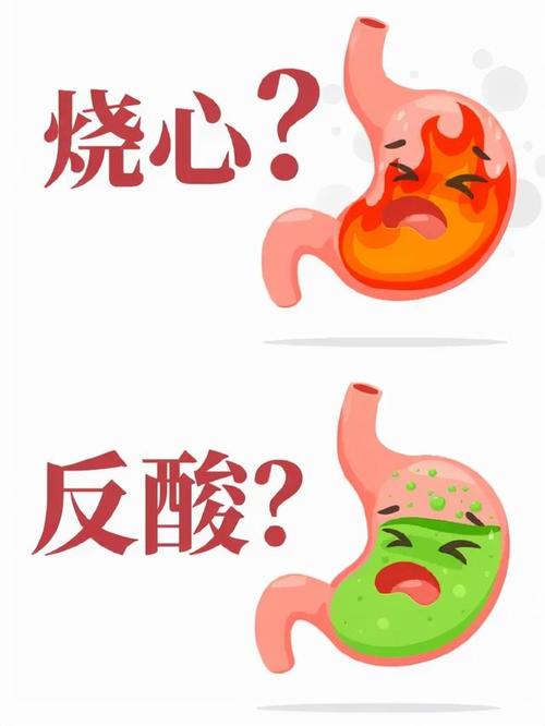 胃反酸烧心怎么调理(老是反酸烧心不舒服)(1)