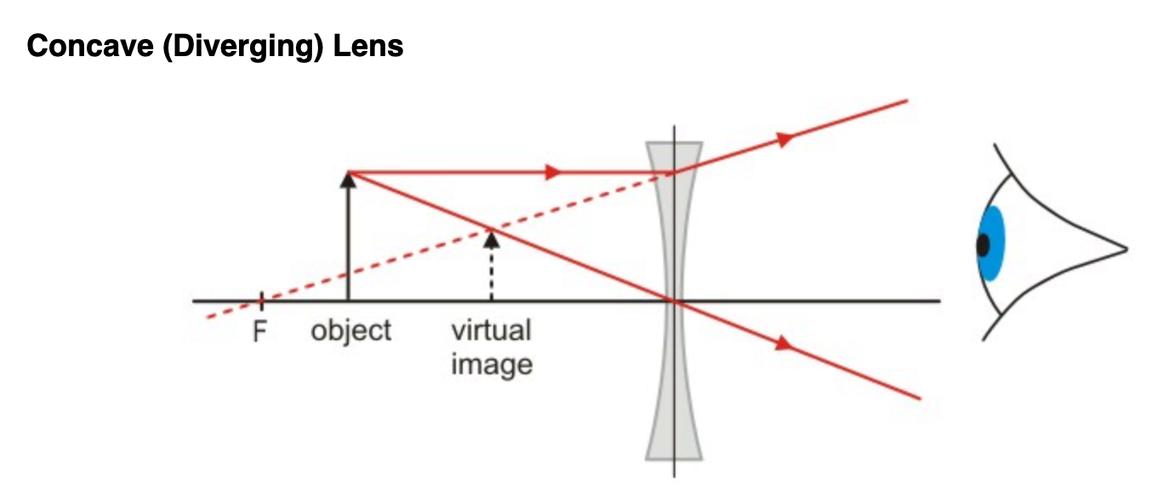 lens),物理学中透镜成像原理告诉我们:凹透镜成像特点是正立缩小虚像