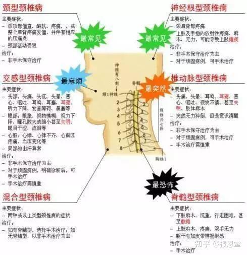 主要症状是上述两种或多种颈部问题.6.混合颈椎病.