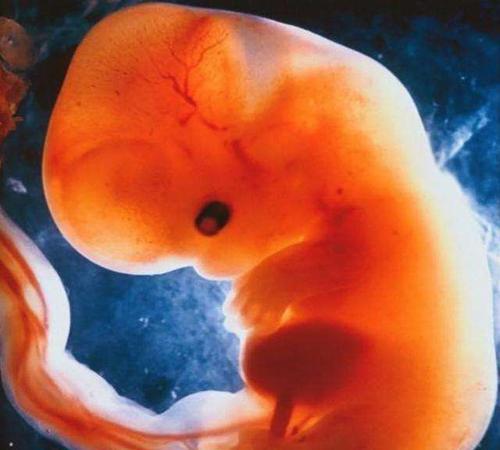 怀孕9周胎儿多大 怀孕9周胎儿稳定了吗
