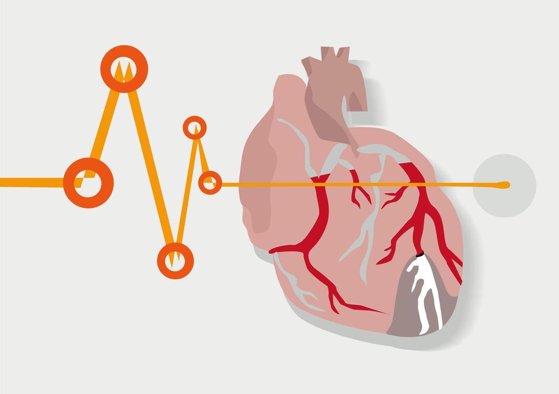 你的心脏建立强大的侧支循环了吗?热爱运动的人可能都会从中受益