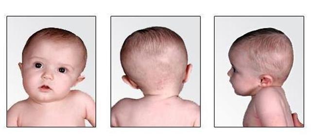 宝宝总往一边看把头转过来就哭婴儿斜颈的可能性要重视