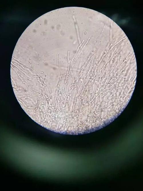 假丝酵母的芽细胞根霉的孢子青霉的帚状丝金黄色葡萄球菌的染色结果
