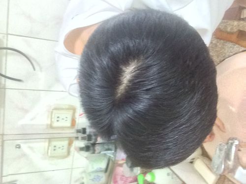 人一天掉多少根头发算是脱发(人一天掉多少根头发算是正常的) - 医药