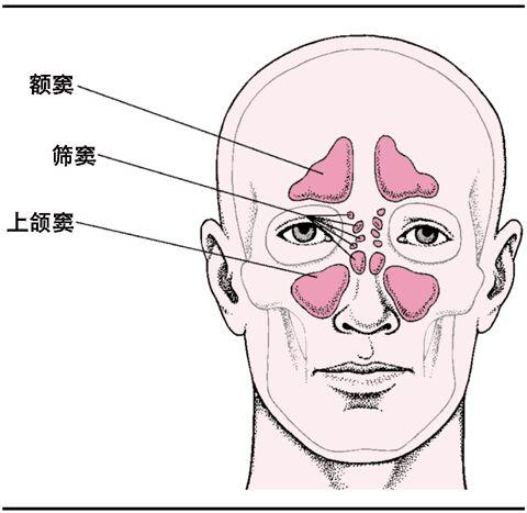 如果有鼻炎症状且鼻窦投影区有压痛,那么您患鼻窦炎的可能性就很大了!