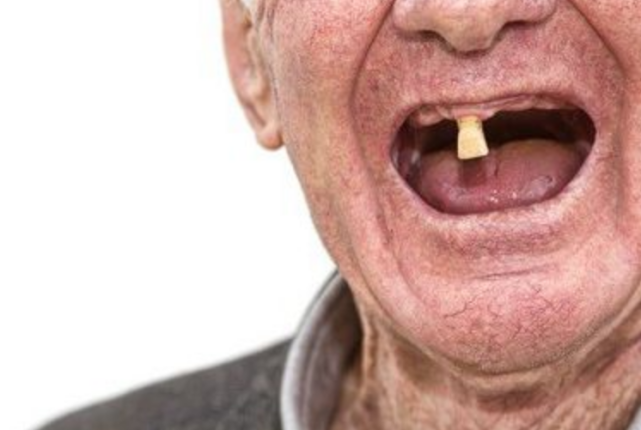 对口腔健康的认识更清晰更全面,那么老年人的牙齿脱落率也会大幅下降
