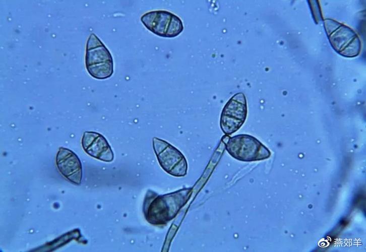 稻瘟病菌的分生孢子