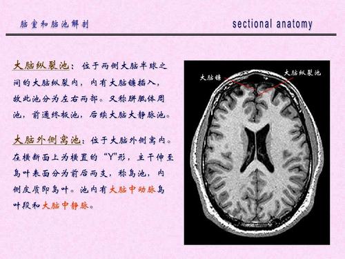 医学院校  本硕连读  解剖学  断层解剖学  ppt 大脑纵裂池:位于两侧