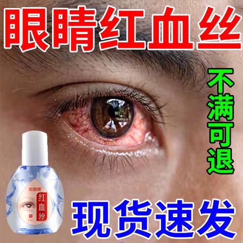 去眼睛红血丝眼药水 眼睛干痒红血丝修复 眼疲劳干涩 酸胀发痒用眼