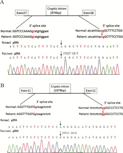 Ⅳ型胶原α5链基因突变致奥尔波特综合征两家系遗传学分析