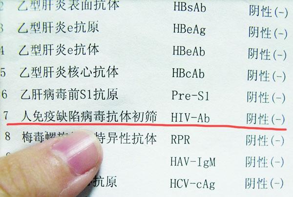 hiv阴性是什么意思