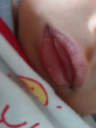 九天的宝宝嘴唇有一层白色的是什么