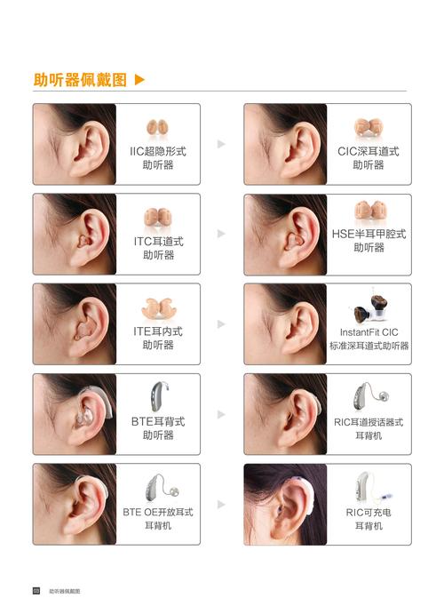 国产助听器以厦门欧仕达,厦门新声,杭州惠耳,杭州爱可声为代表,在不到