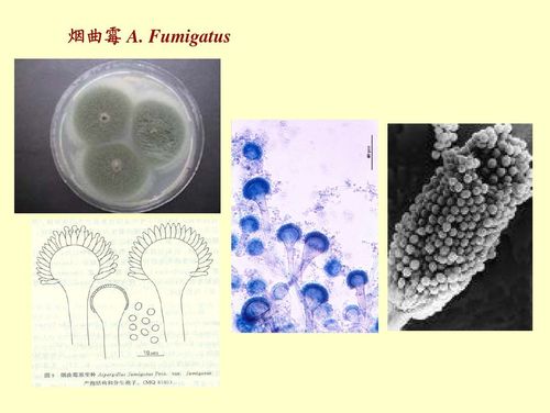 曲霉菌属于子囊菌门,不整囊菌纲.曲霉菌属包括18群,132个种,18个变种.