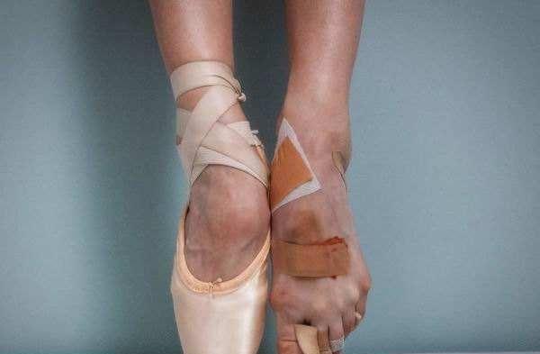 芭蕾舞演员的一双脚伤痕累累让人很心疼