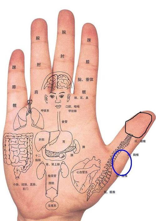 我的右手大拇指疼,图片上黑色线的位置水肿,请问什么毛病,要如何治疗?