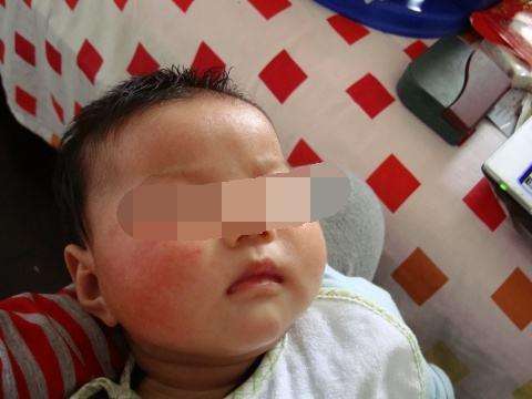 10个月宝宝脸色苍白而且尿血,医生诊断为肾衰竭,只因在家吃了它