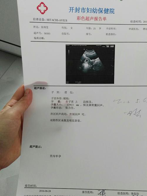 49天去查彩超,医生说还没有胎心胎芽我很担心,医生让过一周再去,宝妈