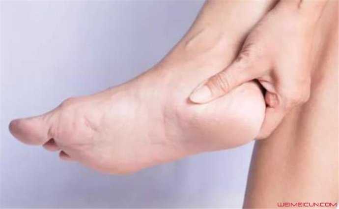 脚后跟疼是什么原因呢 这具体要怎么治疗和预防呢