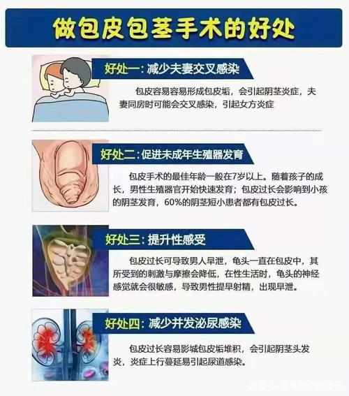郑州科大医院科普做包皮包茎手术的好处