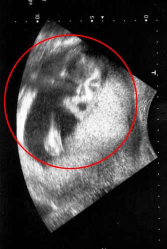 怀孕第六个月胎儿的症状