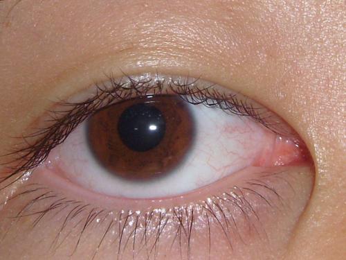 从中医来讲,眼白属心肺,如果心火肺热,眼睛就会发黄,就会有红血丝