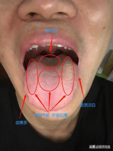 肾气亏虚的舌苔图片