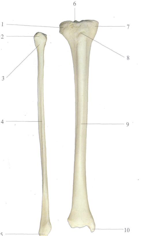 图4-104 胫,腓骨(前面观)-骨科临床解剖学-医学