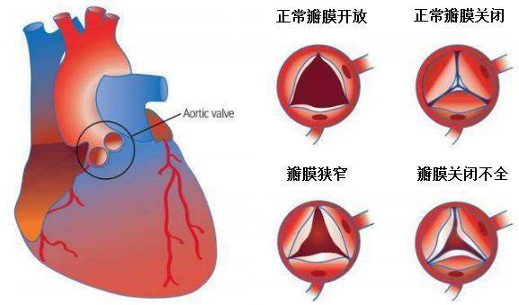 (2)瓣膜关闭不全,就相当于门关不拢,使得心脏收缩时,部分血液倒流.